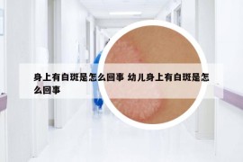 身上有白斑是怎么回事 幼兒身上有白斑是怎么回事