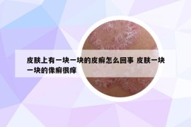 皮膚上有一塊一塊的皮癬怎么回事 皮膚一塊一塊的像癬很癢