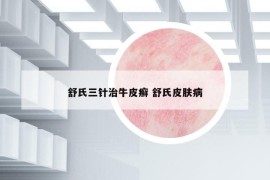 舒氏三針治牛皮癬 舒氏皮膚病