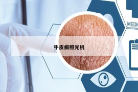牛皮癬照光機(jī)