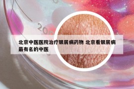 北京中醫(yī)醫(yī)院治療銀屑病藥物 北京看銀屑病最有名的中醫(yī)