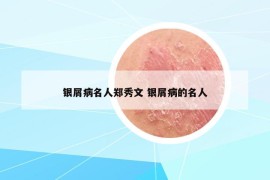 銀屑病名人鄭秀文 銀屑病的名人