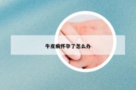 牛皮癬懷孕了怎么辦