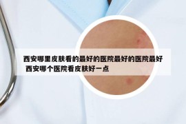 西安哪里皮膚看的最好的醫(yī)院最好的醫(yī)院最好 西安哪個醫(yī)院看皮膚好一點