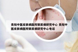 貴陽中醫(yī)皮膚病醫(yī)院銀屑病研究中心 貴陽中醫(yī)皮膚病醫(yī)院銀屑病研究中心電話