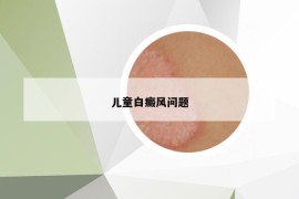兒童白癜風(fēng)問題
