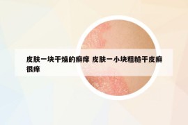 皮膚一塊干燥的癬癢 皮膚一小塊粗糙干皮癬很癢
