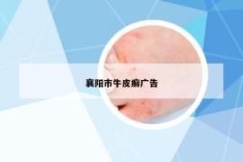 襄陽市牛皮癬廣告