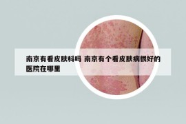 南京有看皮膚科嗎 南京有個(gè)看皮膚病很好的醫(yī)院在哪里