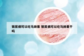 銀屑病可以吃馬蹄果 銀屑病可以吃馬蹄果干嗎
