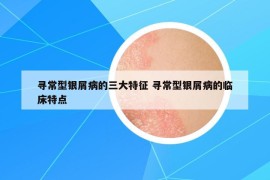 尋常型銀屑病的三大特征 尋常型銀屑病的臨床特點