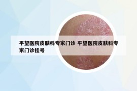 平望醫(yī)院皮膚科專(zhuān)家門(mén)診 平望醫(yī)院皮膚科專(zhuān)家門(mén)診掛號(hào)