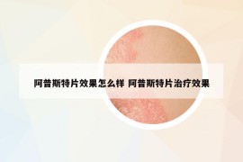 阿普斯特片效果怎么樣 阿普斯特片治療效果