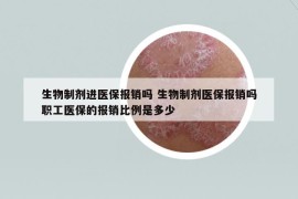 生物制劑進醫(yī)保報銷嗎 生物制劑醫(yī)保報銷嗎職工醫(yī)保的報銷比例是多少