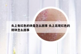 頭上有紅色的塊是怎么回事 頭上出現(xiàn)紅色的斑塊怎么回事