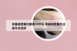 可善挺密集針都是10針么 可善挺密集針過后不太見好