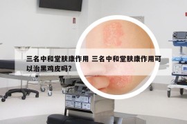 三名中和堂膚康作用 三名中和堂膚康作用可以治黑雞皮嗎?
