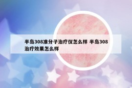 半島308準(zhǔn)分子治療儀怎么樣 半島308治療效果怎么樣