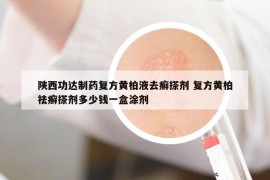 陜西功達(dá)制藥復(fù)方黃柏液去癬搽劑 復(fù)方黃柏祛癬搽劑多少錢一盒涂劑