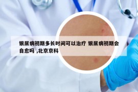 銀屑病初期多長時間可以治療 銀屑病初期會自愈嗎 ,北京京科