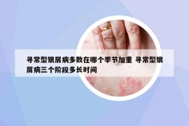 尋常型銀屑病多數(shù)在哪個(gè)季節(jié)加重 尋常型銀屑病三個(gè)階段多長(zhǎng)時(shí)間