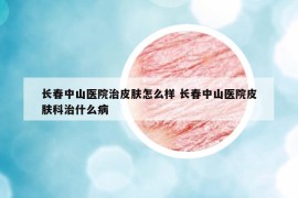 長春中山醫(yī)院治皮膚怎么樣 長春中山醫(yī)院皮膚科治什么病