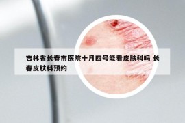 吉林省長春市醫(yī)院十月四號(hào)能看皮膚科嗎 長春皮膚科預(yù)約