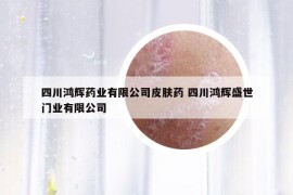 四川鴻輝藥業(yè)有限公司皮膚藥 四川鴻輝盛世門業(yè)有限公司