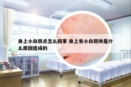 身上小白斑點怎么回事 身上有小白斑塊是什么原因造成的