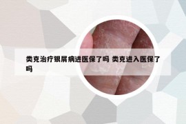 類克治療銀屑病進(jìn)醫(yī)保了嗎 類克進(jìn)入醫(yī)保了嗎