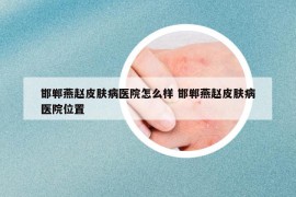 邯鄲燕趙皮膚病醫(yī)院怎么樣 邯鄲燕趙皮膚病醫(yī)院位置