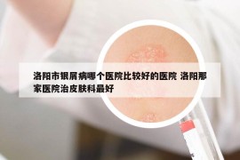 洛陽市銀屑病哪個醫(yī)院比較好的醫(yī)院 洛陽那家醫(yī)院治皮膚科最好