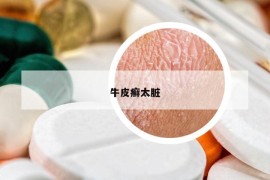 牛皮癬太臟