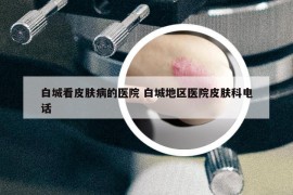白城看皮膚病的醫(yī)院 白城地區(qū)醫(yī)院皮膚科電話