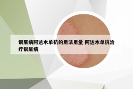 銀屑病阿達(dá)木單抗的用法用量 阿達(dá)木單抗治療銀屑病
