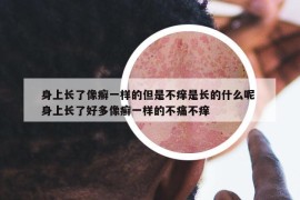 身上長(zhǎng)了像癬一樣的但是不癢是長(zhǎng)的什么呢 身上長(zhǎng)了好多像癬一樣的不痛不癢