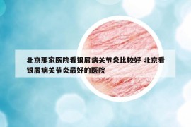 北京那家醫(yī)院看銀屑病關節(jié)炎比較好 北京看銀屑病關節(jié)炎最好的醫(yī)院