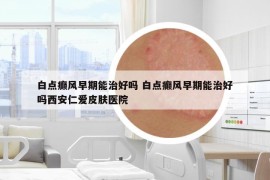 白點癲風早期能治好嗎 白點癲風早期能治好嗎西安仁愛皮膚醫(yī)院