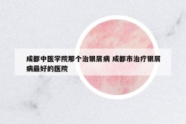 成都中醫(yī)學(xué)院那個治銀屑病 成都市治療銀屑病最好的醫(yī)院