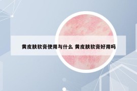黃皮膚軟膏使用與什么 黃皮膚軟膏好用嗎