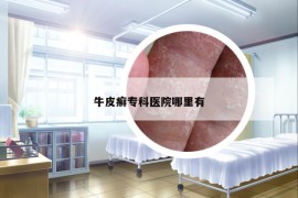 牛皮癬?？漆t(yī)院哪里有