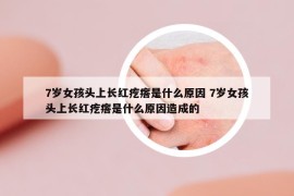 7歲女孩頭上長(zhǎng)紅疙瘩是什么原因 7歲女孩頭上長(zhǎng)紅疙瘩是什么原因造成的