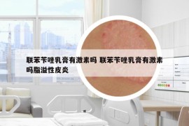 聯(lián)苯芐唑乳膏有激素嗎 聯(lián)苯芐唑乳膏有激素嗎脂溢性皮炎