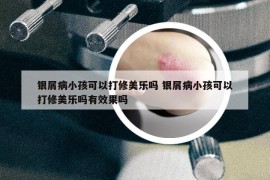 銀屑病小孩可以打修美樂嗎 銀屑病小孩可以打修美樂嗎有效果嗎