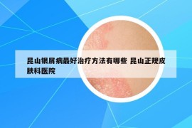昆山銀屑病最好治療方法有哪些 昆山正規(guī)皮膚科醫(yī)院