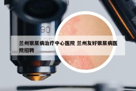 蘭州銀屑病治療中心醫(yī)院 蘭州友好銀屑病醫(yī)院招聘