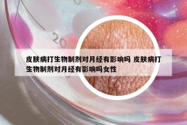 皮膚病打生物制劑對月經(jīng)有影響嗎 皮膚病打生物制劑對月經(jīng)有影響嗎女性