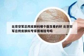 北京空軍總院皮膚科哪個醫(yī)生看的好 北京空軍總院皮膚科專家很難掛號嗎