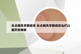 白點癲風早期癥狀 白點癲風早期癥狀治療口服藥有哪些