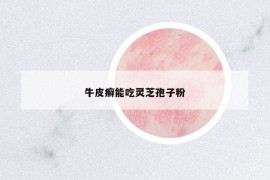 牛皮癬能吃靈芝孢子粉